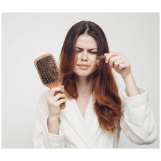 Plaukų slinkimas - dažniausios priežastys
